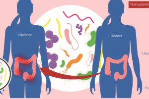 Transplante de Microbiota Fecal